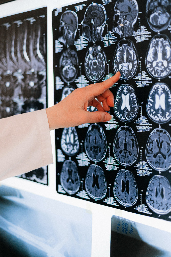 MRI scan images